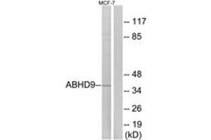 Western blot analysis of extracts from MCF-7 cells, using ABHD9 Antibody. (ABHD9 antibody  (AA 101-150))