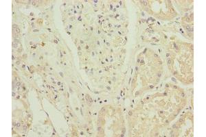 Immunohistochemistry of paraffin-embedded human kidney tissue using ABIN7176421 at dilution of 1:100 (ZNF596 antibody  (AA 201-504))