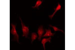 ABIN6274120 staining A549 by IF/ICC. (SLC43A1 antibody  (Internal Region))