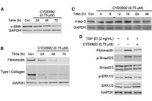 Western Blotting (WB) image for anti-COL1A2/COL1A1 antibody (ABIN5596819)