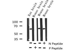 Western blot analysis of Phospho-p62 Dok (Tyr362) expression in various lysates (DOK1 antibody  (pTyr362))