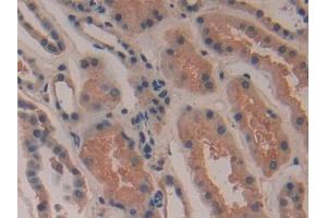 Immunohistochemistry (IHC) image for anti-Cytochrome C Oxidase Subunit II (COX2) (AA 418-589) antibody (ABIN7444103)