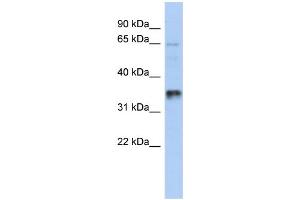 WB Suggested Anti-UBAC2 Antibody Titration: 0. (UBAC2 antibody  (Middle Region))