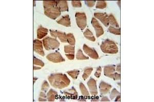 ATP2A1 Antibody (C-term) (ABIN1881089 and ABIN2840069) IHC analysis in formalin fixed and paraffin embedded human skeletal muscle followed by peroxidase conjugation of the secondary antibody and DAB staining. (ATP2A1/SERCA1 antibody  (C-Term))