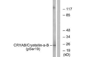 Western blot analysis of extracts from HepG2 cells, treated with nocodazole (1ug/ml, 16hours), using CRYAB/Crystallin-α-B (Phospho-Ser19) antibody. (CRYAB antibody  (pSer19))