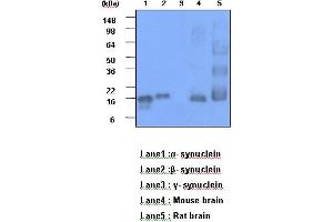 The recombinant human synuclein family (alpha-,beta- and gamma-) (each 20ng), Mouse brain and Rat brain (30 ug) were resolved by SDS-PAGE, transferred to PVDF membrane and probed with anti-human alpha,beta-synuclein (1:1000). (alpha (AA 119-140) antibody)