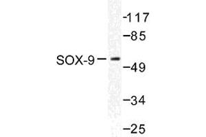 Image no. 1 for anti-SRY (Sex Determining Region Y)-Box 9 (SOX9) antibody (ABIN272082) (SOX9 antibody)