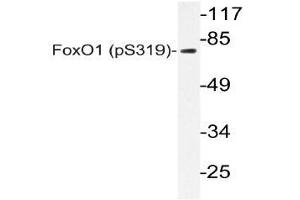 Western blot (WB) analyzes of p-FoxO1 antibody in extracts from 293 SERUM cells.