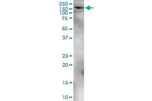 Immunoprecipitation of MGEA5 transfected lysate using anti-MGEA5 MaxPab rabbit polyclonal antibody and Protein A Magnetic Bead , and immunoblotted with MGEA5 MaxPab mouse polyclonal antibody (B01) . (MGEA5 antibody  (AA 1-916))