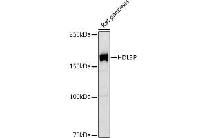 Western blot analysis of extracts of Rat pancreas, using HDLBP antibody (ABIN7267644) at 1:1000 dilution. (HDLBP antibody)