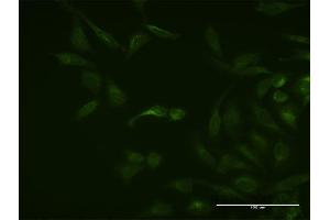 Immunofluorescence of monoclonal antibody to ASB3 on HeLa cell.