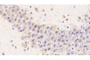 Detection of CTSD in Mouse Cerebellum Tissue using Polyclonal Antibody to Cathepsin D (CTSD) (Cathepsin D antibody  (AA 66-410))