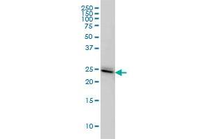 PAFAH1B3 monoclonal antibody (M02), clone 8C11 Western Blot analysis of PAFAH1B3 expression in IMR-32 . (PAFAH1B3 antibody  (AA 1-231))