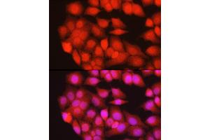 Immunofluorescence analysis of HeLa cells using TRIM63 Rabbit pAb (ABIN3017372, ABIN3017373, ABIN3017374 and ABIN6220060) at dilution of 1:200 (40x lens).