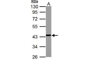 WB Image NDUFA10 antibody detects NDUFA10 protein by Western blot analysis. (NDUFA10 antibody  (Center))