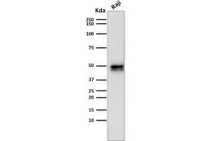 ABIN6383859 to CD79a was successfully used to stain an approx. (Recombinant CD79a antibody  (AA 202-216))