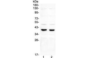 Western blot testing of 1) rat testis, 2) mouse testis, 3) rat brain, 4) mouse brain and 5) human U87 lysate with DMRT1 antibody.