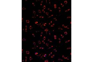 Immunofluorescence analysis of L929 cells using PAH antibody (ABIN3015512, ABIN3015513, ABIN3015514 and ABIN6218620) at dilution of 1:100. (Phenylalanine Hydroxylase antibody  (AA 1-290))