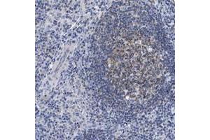 Immunohistochemical staining of human lymph node with LRMP polyclonal antibody  shows moderate cytoplasmic positivity in reaction center cells at 1:500-1:1000 dilution.