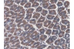 #VALUE! (ATP4A antibody  (AA 786-1014))