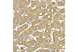 Immunohistochemistry of paraffin-embedded human liver using β-Tubulin Rabbit pAb (ABIN3020552, ABIN3020553 and ABIN3020554) at dilution of 1:250 (40x lens). (TUBB antibody  (AA 40-260))