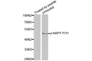 Western blot analysis of extracts from mouse brain tissue using Phospho-MAPT-T231 antibody (ABIN2988163). (MAPT antibody  (pThr231))