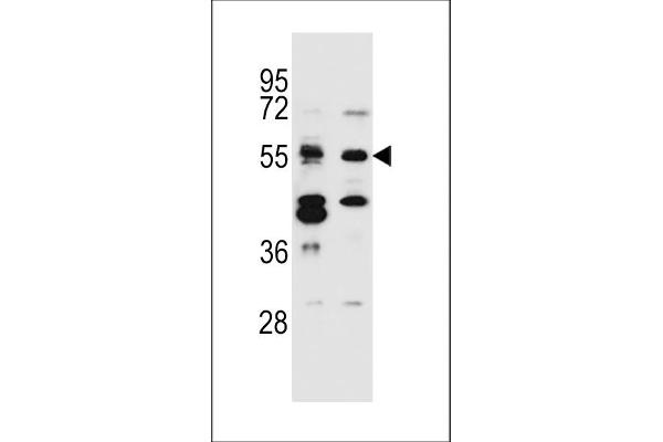 CELF3 antibody  (N-Term)