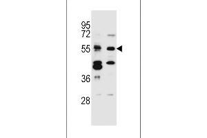 TNRC4 Antibody (N-term) (ABIN657011 and ABIN2846191) western blot analysis in Jurkat,MDA-M cell line lysates (35 μg/lane).