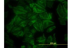 Immunofluorescence of monoclonal antibody to PDLIM7 on HeLa cell. (PDLIM7 antibody  (AA 1-457))