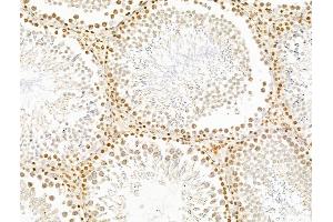 ABIN7094797 and ABIN7098848 at 1/100 staining Rat testis tissue by IHC-P. (TIMD4 antibody  (Internal Region))