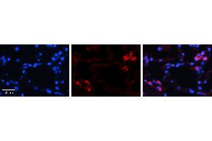 Immunohistochemistry (IHC) image for anti-Insulin-Like Growth Factor Binding Protein 7 (IGFBP7) (C-Term) antibody (ABIN2773913) (IGFBP7 antibody  (C-Term))