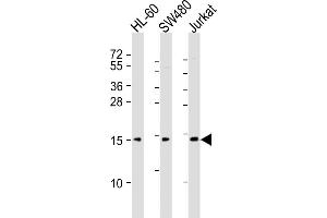 All lanes : Anti-KISS1 Antibody (C-Term) at 1:2000 dilution Lane 1: HL-60 whole cell lysates Lane 2: S whole cell lysates Lane 3: Jurkat whole cell lysates Lysates/proteins at 20 μg per lane. (KISS1 antibody  (AA 115-145))