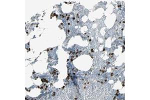 Immunohistochemical staining (Formalin-fixed paraffin-embedded sections) of human bone marrow with TPX2 polyclonal antibody  shows strong nuclear positivity in bone marrow poietic cells.