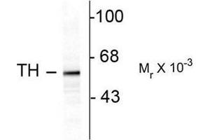 Image no. 1 for anti-Tyrosine Hydroxylase (TH) antibody (ABIN372735) (Tyrosine Hydroxylase antibody)