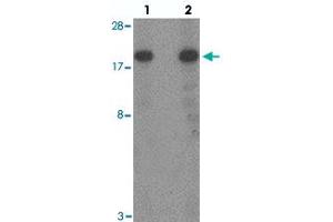 Western blot analysis of TSC22D3 in human small intestine tissue with TSC22D3 polyclonal antibody  at (lane 1) 1 and (lane 2) 2 ug/mL.
