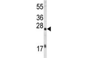 Western blot analysis of EIF4E antibody and HL-60 lysate. (EIF4E antibody)