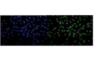 IF analysis of Transketolase/TKT using anti-Transketolase/TKT antibody (ABIN7598958). (TKT antibody  (AA 1-116))