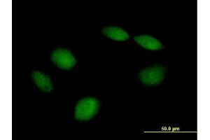Immunofluorescence of purified MaxPab antibody to PHF21B on HeLa cell. (PHF21B antibody  (AA 1-531))