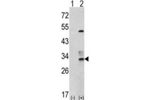 Western Blotting (WB) image for anti-Capping Protein (Actin Filament) Muscle Z-Line, beta (CAPZB) antibody (ABIN3001693) (CAPZB antibody)