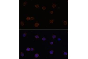 Immunofluorescence analysis of Y79 cells using  Polyclonal Antibody (ABIN6129705, ABIN6136904, ABIN6136906 and ABIN6220328) at dilution of 1:100 (40x lens). (Anoctamin 2 antibody  (AA 1-200))