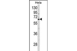 Western blot analysis of CTPS2 Antibody (N-term) (ABIN652725 and ABIN2842481) in Hela cell line lysates (35 μg/lane).