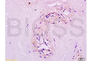 Formalin-fixed and paraffin embedded human placenta tissue labeled with Anti MFSD2A Polyclonal Antibody, unconjugated (ABIN762026) at 1:200 followed by incubation with conjugated secondary antibody and DAB staining (MFSD2A antibody  (AA 331-430))