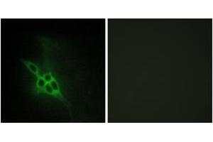Immunofluorescence analysis of NIH-3T3 cells, using EPHB1/2/3 Antibody. (EPH Receptor B1/2/3 (AA 631-680) antibody)