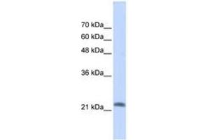 Image no. 1 for anti-RAS-Like, Family 10, Member A (RASL10A) (AA 35-84) antibody (ABIN6741126) (RASL10A antibody  (AA 35-84))