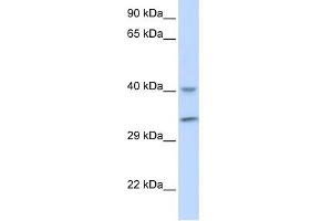 WB Suggested Anti-ALKBH3 Antibody Titration: 0. (ALKBH3 antibody  (Middle Region))