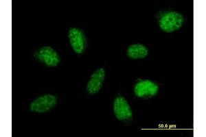 Immunofluorescence of purified MaxPab antibody to MED29 on HeLa cell.
