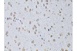 Immunohistochemistry (Paraffin-embedded Sections) (IHC (p)) image for anti-Lamin B2 (LMNB2) (AA 341-620) antibody (ABIN6143268)