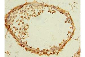 Immunohistochemistry of paraffin-embedded human testis tissue using ABIN7173115 at dilution of 1:100 (TMEM186 antibody  (AA 124-213))