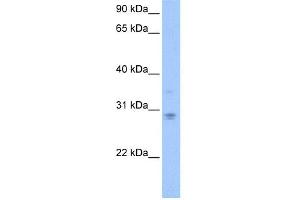 WB Suggested Anti-DCUN1D3 Antibody Titration: 0. (DCUN1D3 antibody  (C-Term))