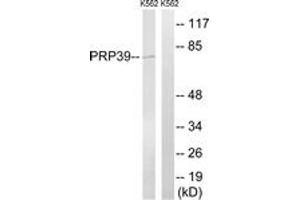 Western blot analysis of extracts from K562 cells, using PRPF39 Antibody. (PRPF39 antibody  (AA 263-312))